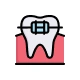 Orthodontic dental braces icon.